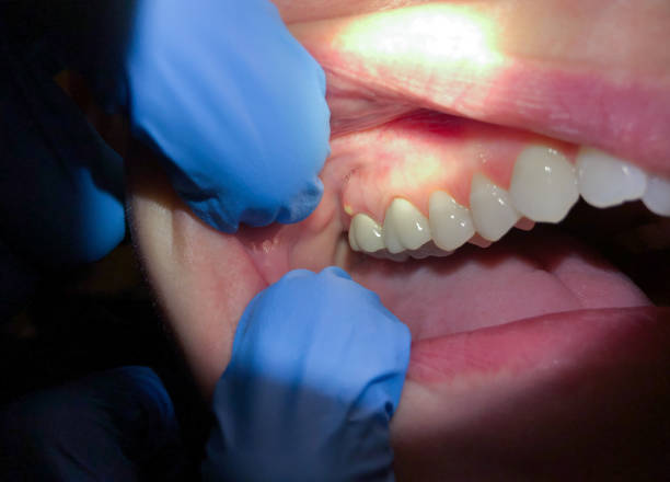 Best Urgent Dental Care for Toothaches in Kadelphia, AR