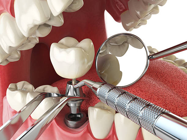 Best Emergency Orthodontic Repairs in Kadelphia, AR